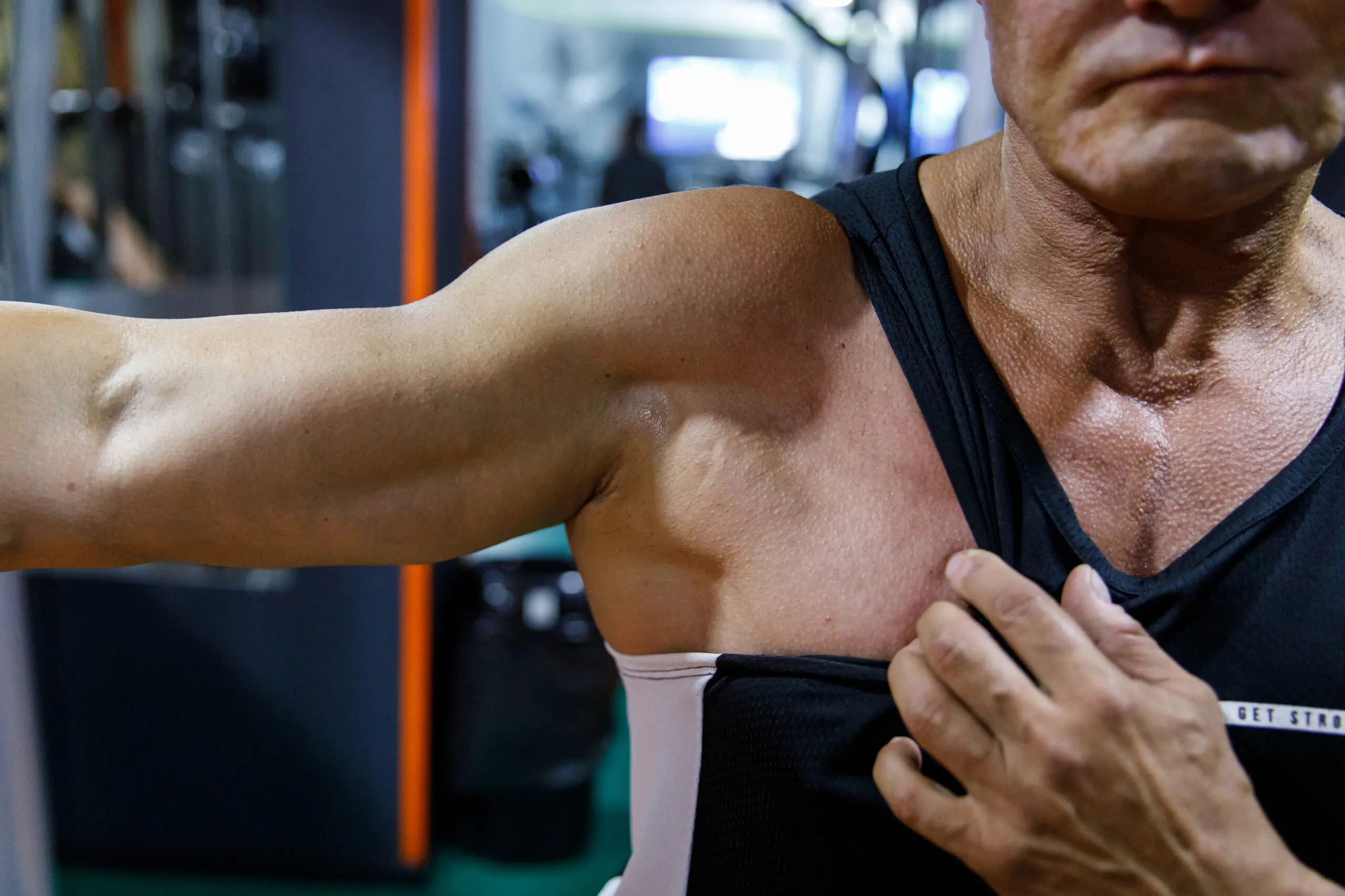 Anna pulls her tank top aside to show the location of her shoulder injury.